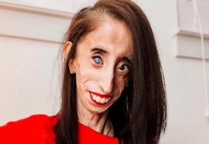 Lizzie Velasquez Height, Weight, Measurements, Wiki, Age, Biography